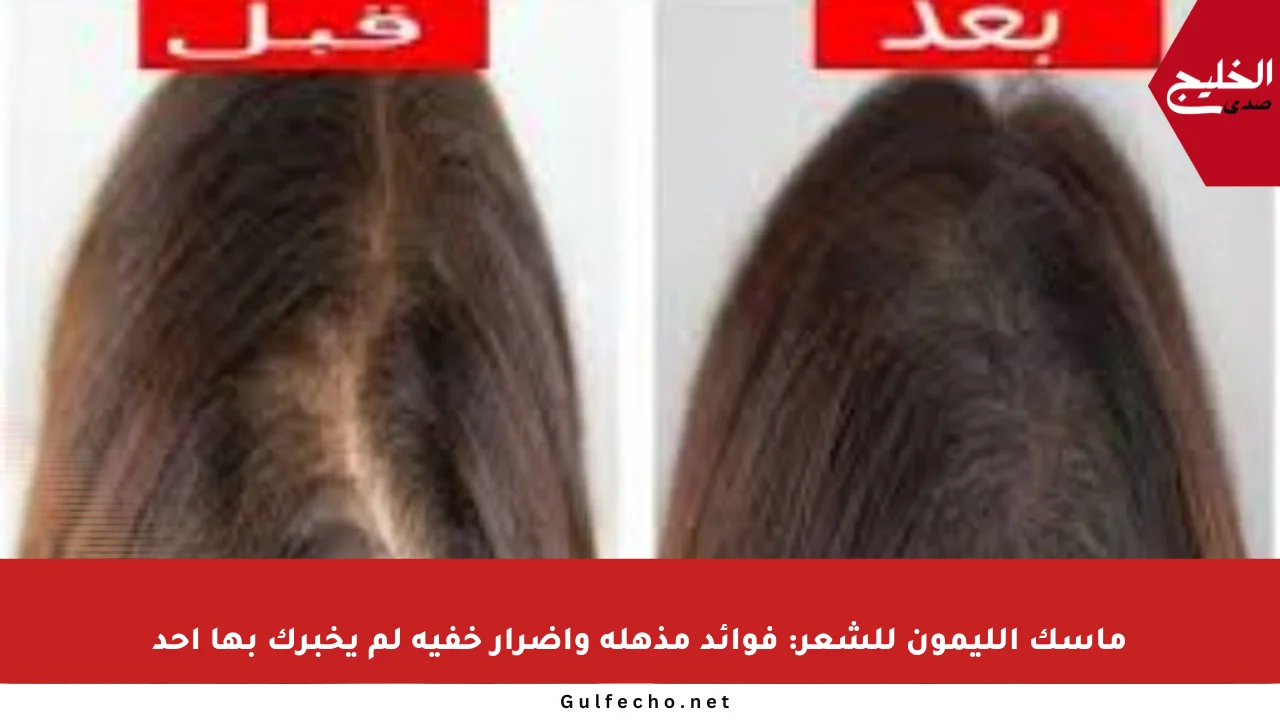 ماسك الليمون للشعر: فوائد مذهلة وأضرار خفية لم يخبرك بها أحد